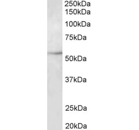 Western Blot - Anti-beta III Tubulin Antibody (A82686) - Antibodies.com