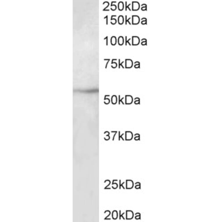 Western Blot - Anti-beta III Tubulin Antibody (A82686) - Antibodies.com