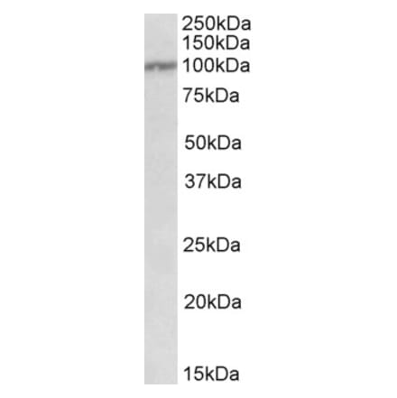 Western Blot - Anti-IL-12RB1 Antibody (A82689) - Antibodies.com