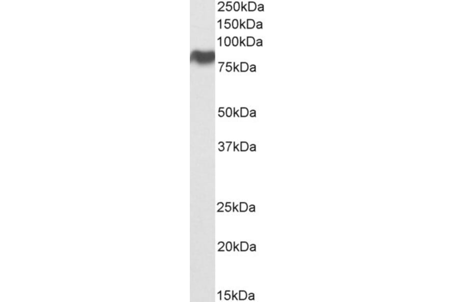 Western Blot - Anti-Scavenging Receptor SR-BI Antibody (A82690) - Antibodies.com
