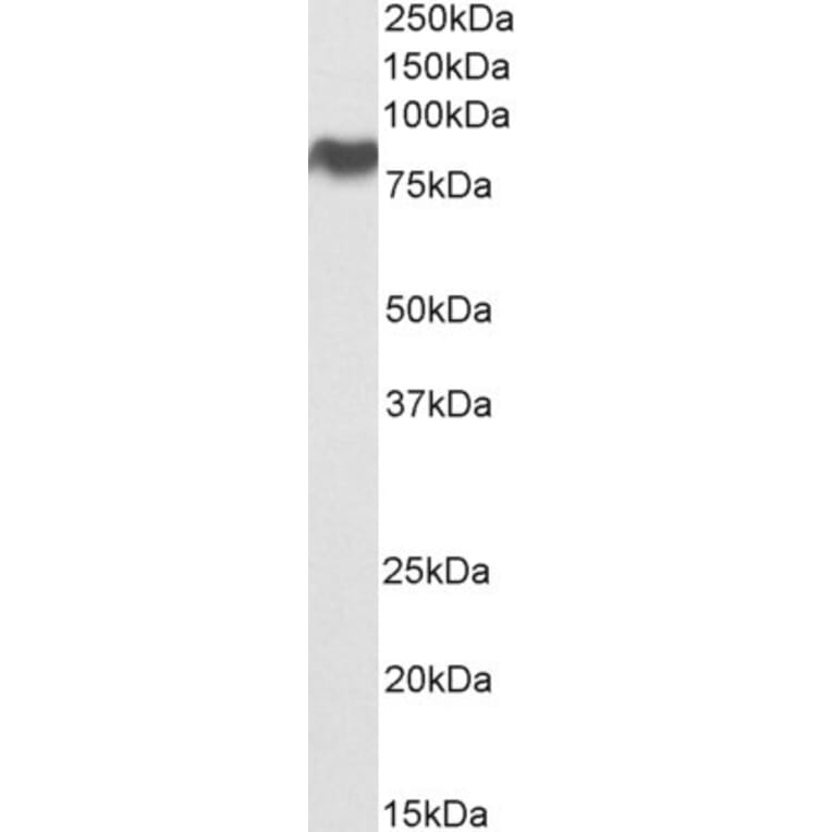 Western Blot - Anti-Scavenging Receptor SR-BI Antibody (A82690) - Antibodies.com