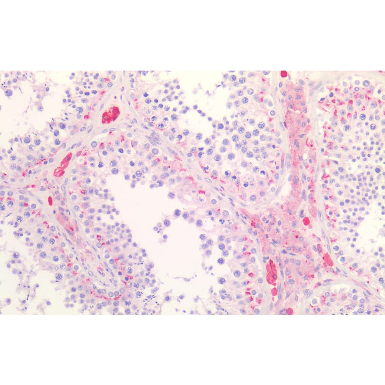 Immunohistochemistry - Anti-Scavenging Receptor SR-BI Antibody (A82690) - Antibodies.com