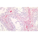 Immunohistochemistry - Anti-Scavenging Receptor SR-BI Antibody (A82690) - Antibodies.com
