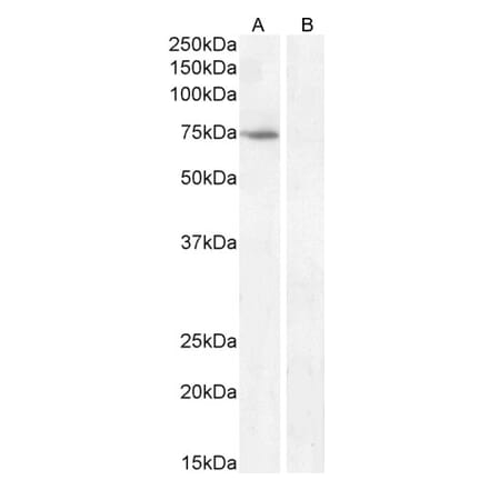 Western Blot - Anti-Fez1 Antibody (A82691) - Antibodies.com