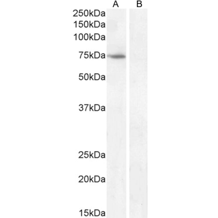 Western Blot - Anti-Fez1 Antibody (A82691) - Antibodies.com