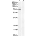 Western Blot - Anti-Fez1 Antibody (A82691) - Antibodies.com