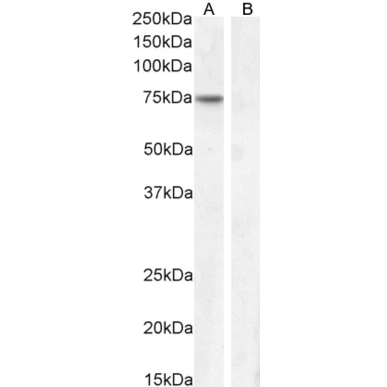 Western Blot - Anti-Fez1 Antibody (A82691) - Antibodies.com