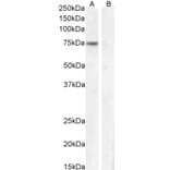 Western Blot - Anti-Fez1 Antibody (A82691) - Antibodies.com