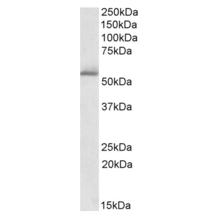 Western Blot - Anti-PDE1A Antibody (A82692) - Antibodies.com