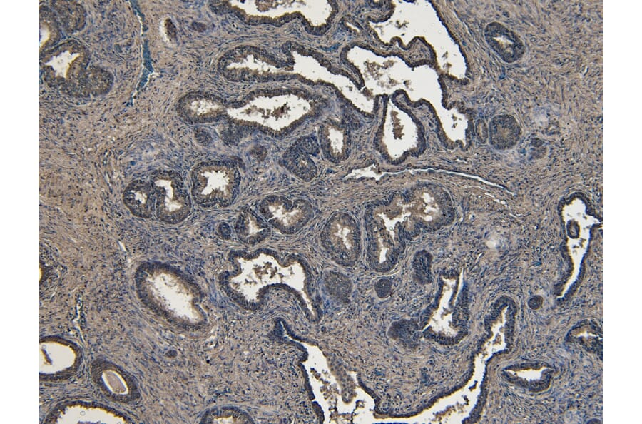 Immunohistochemistry - Anti-ROR1 Antibody (A82693) - Antibodies.com