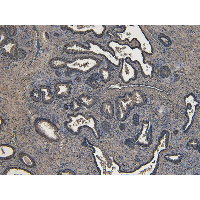 Immunohistochemistry - Anti-ROR1 Antibody (A82693) - Antibodies.com
