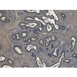 Immunohistochemistry - Anti-ROR1 Antibody (A82693) - Antibodies.com