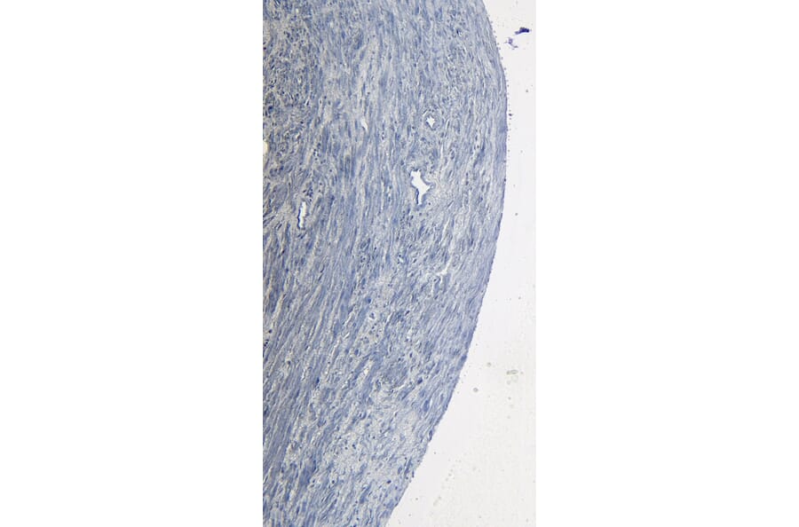 Immunohistochemistry - Anti-ROR1 Antibody (A82693) - Antibodies.com