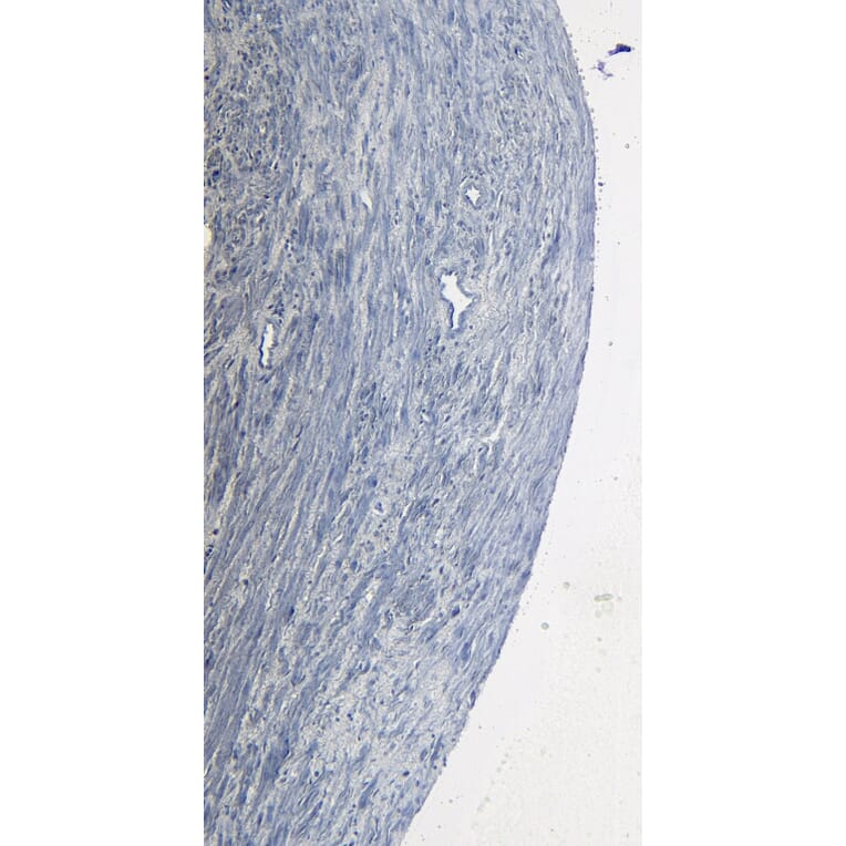 Immunohistochemistry - Anti-ROR1 Antibody (A82693) - Antibodies.com