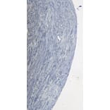 Immunohistochemistry - Anti-ROR1 Antibody (A82693) - Antibodies.com