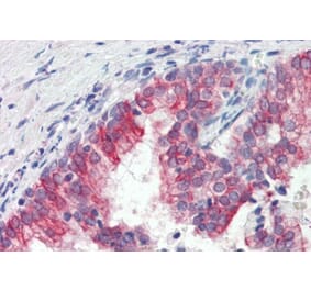 Immunohistochemistry - Anti-ROR1 Antibody (A82693) - Antibodies.com