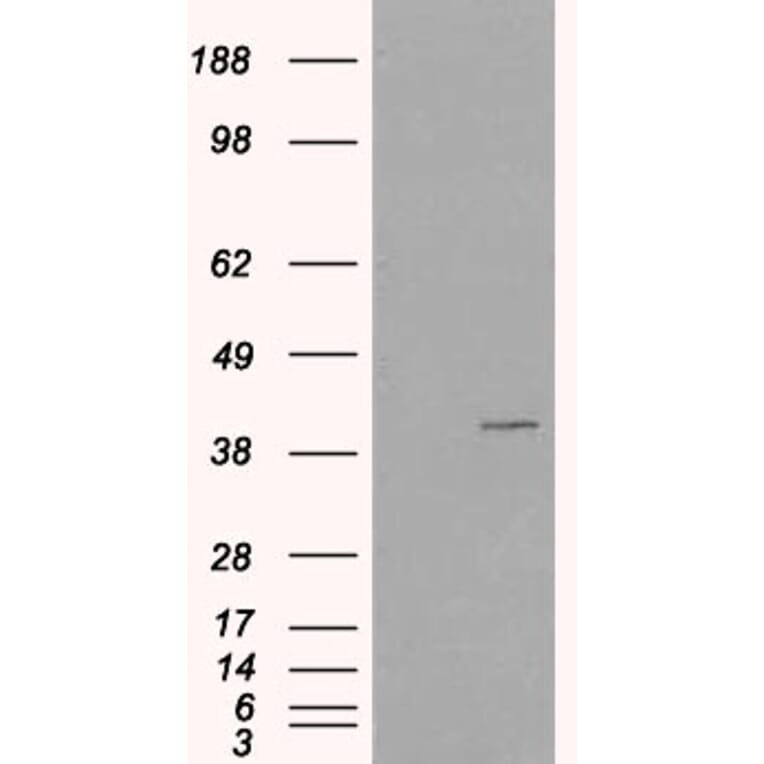 Western Blot - Anti-VPS26A Antibody (A82694) - Antibodies.com