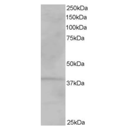 Western Blot - Anti-VPS26A Antibody (A82694) - Antibodies.com