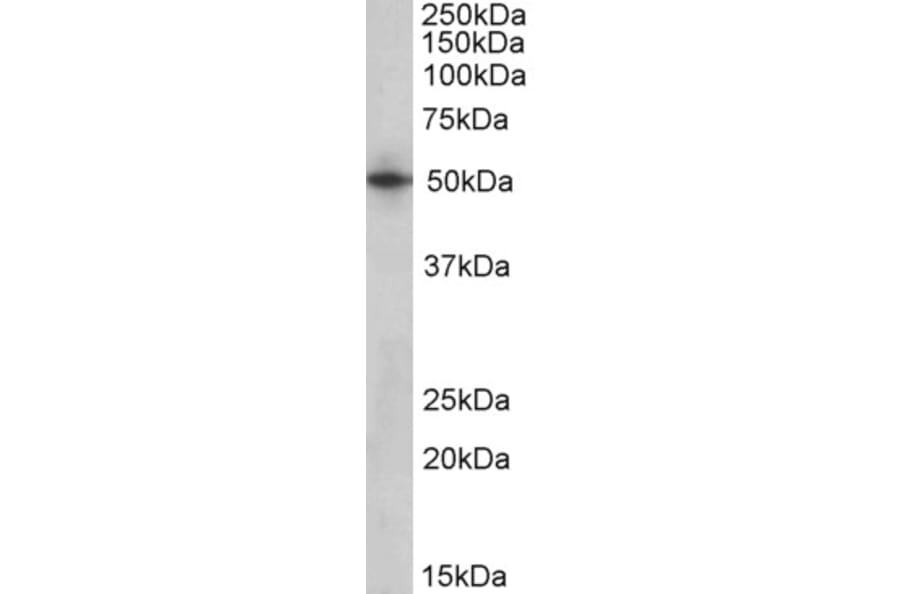 Western Blot - Anti-SEPT4 Antibody (A82695) - Antibodies.com