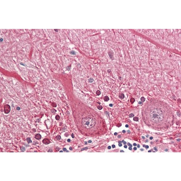 Immunohistochemistry - Anti-SEPT4 Antibody (A82695) - Antibodies.com
