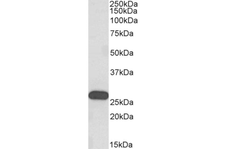 Western Blot - Anti-HoxC6 Antibody (A82696) - Antibodies.com