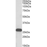 Western Blot - Anti-HoxC6 Antibody (A82696) - Antibodies.com