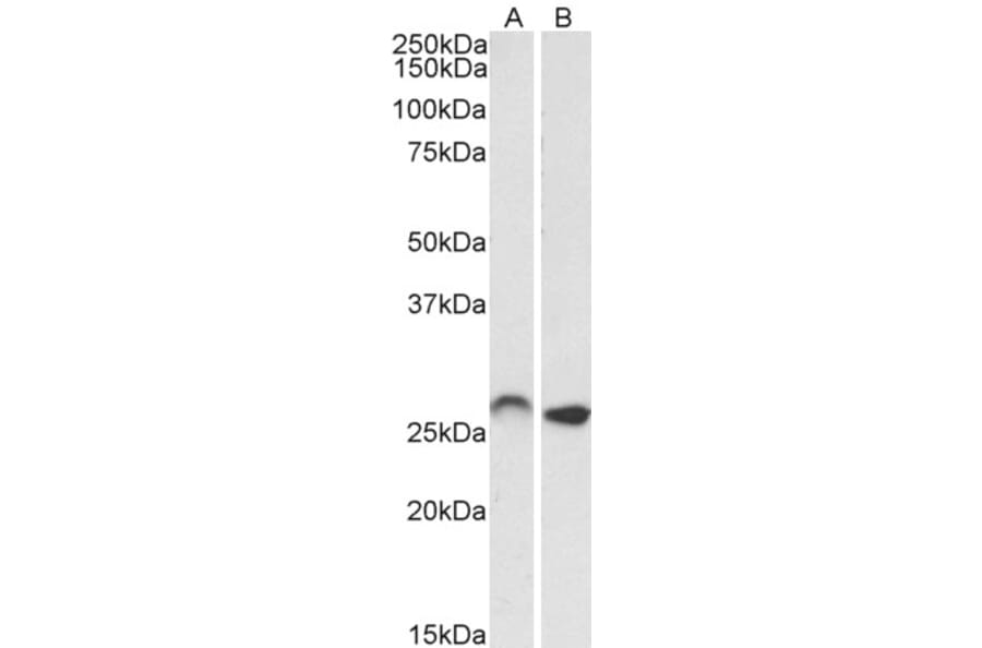 Western Blot - Anti-HoxC6 Antibody (A82696) - Antibodies.com