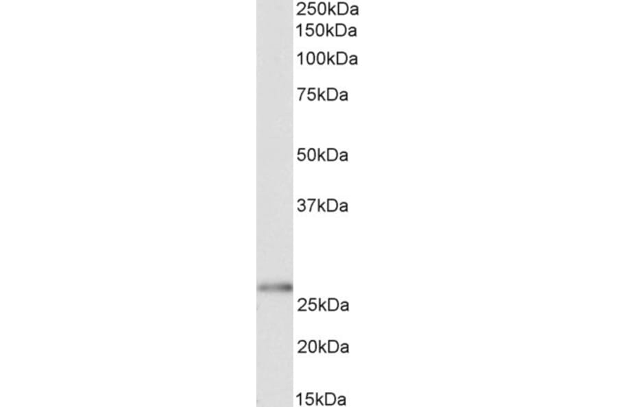Western Blot - Anti-HoxC6 Antibody (A82696) - Antibodies.com