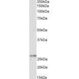 Western Blot - Anti-HoxC6 Antibody (A82696) - Antibodies.com