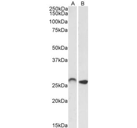 Western Blot - Anti-HOXC6 Antibody (A82696) - Antibodies.com