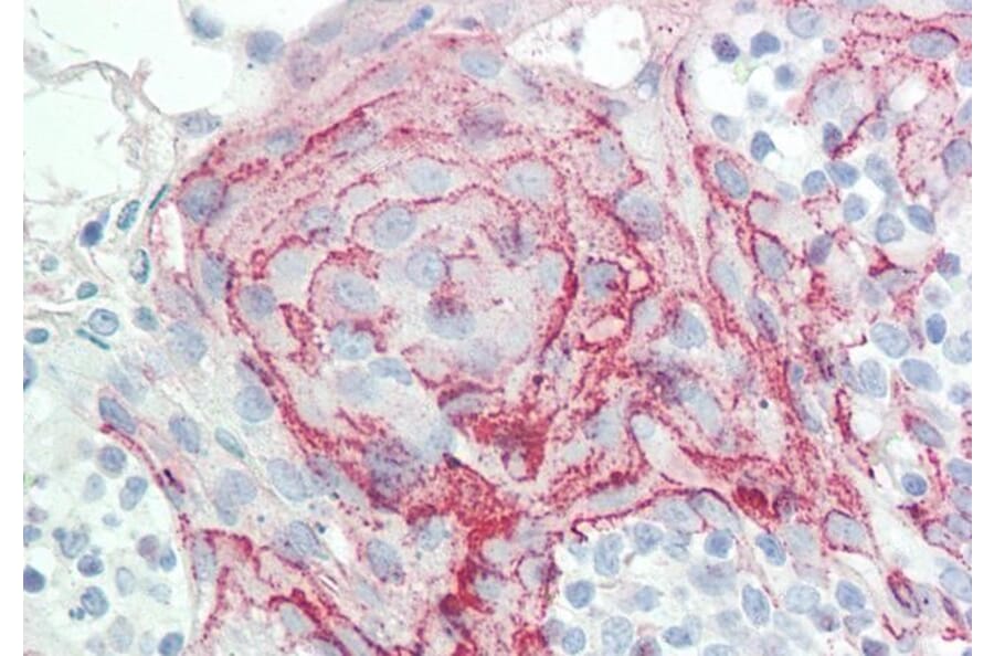 Immunohistochemistry - Anti-HoxC6 Antibody (A82696) - Antibodies.com