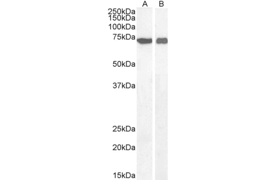 Western Blot - Anti-AIF Antibody (A82697) - Antibodies.com
