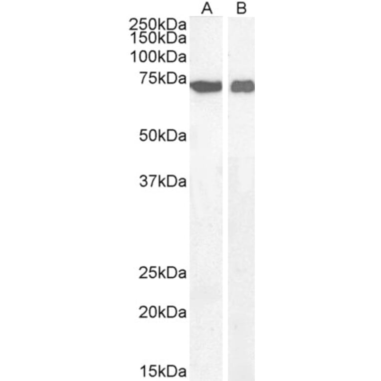 Western Blot - Anti-AIF Antibody (A82697) - Antibodies.com