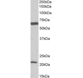 Western Blot - Anti-EAAT1 Antibody (A82699) - Antibodies.com