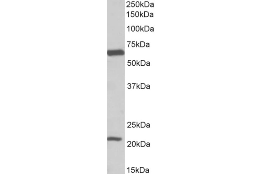 Western Blot - Anti-EAAT1 Antibody (A82699) - Antibodies.com
