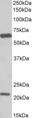 Anti-SLC1A3 Antibody (A82699) (0.1µg/ml) staining of Human Frontal Cortex lysate (35µg protein in RIPA buffer). Primary incubation was 1 hour. Detected by chemiluminescence.