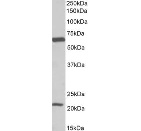 Western Blot - Anti-SLC1A3 Antibody (A82699) - Antibodies.com