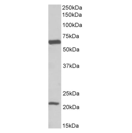 Western Blot - Anti-SLC1A3 Antibody (A82699) - Antibodies.com