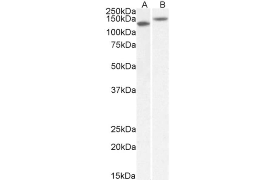Western Blot - Anti-Contactin 1 Antibody (A82703) - Antibodies.com