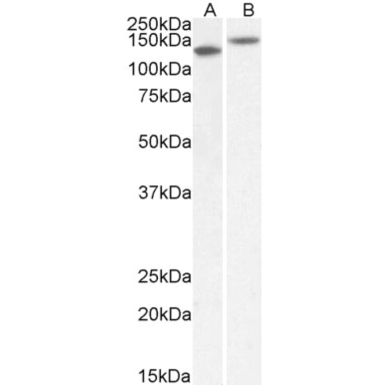 Western Blot - Anti-Contactin 1 Antibody (A82703) - Antibodies.com