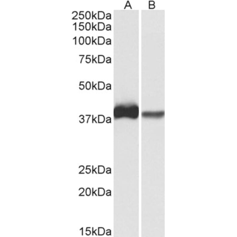 Western Blot - Anti-Actin Regulatory Protein CAPG/MCP Antibody (A82704) - Antibodies.com