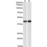 Western Blot - Anti-Actin Regulatory Protein CAPG/MCP Antibody (A82704) - Antibodies.com
