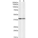 Western Blot - Anti-Actin Regulatory Protein CAPG/MCP Antibody (A82704) - Antibodies.com