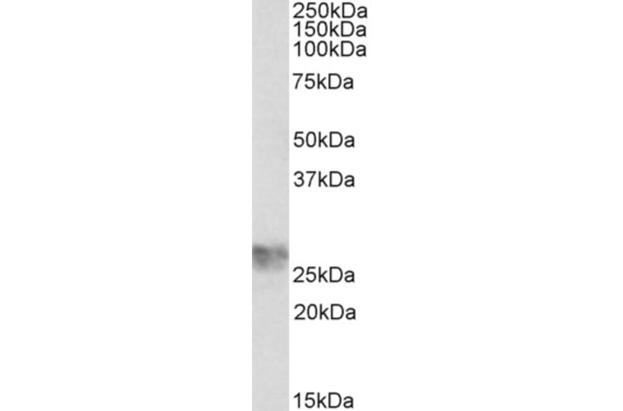 Western Blot - Anti-ICAM4 Antibody (A82705) - Antibodies.com