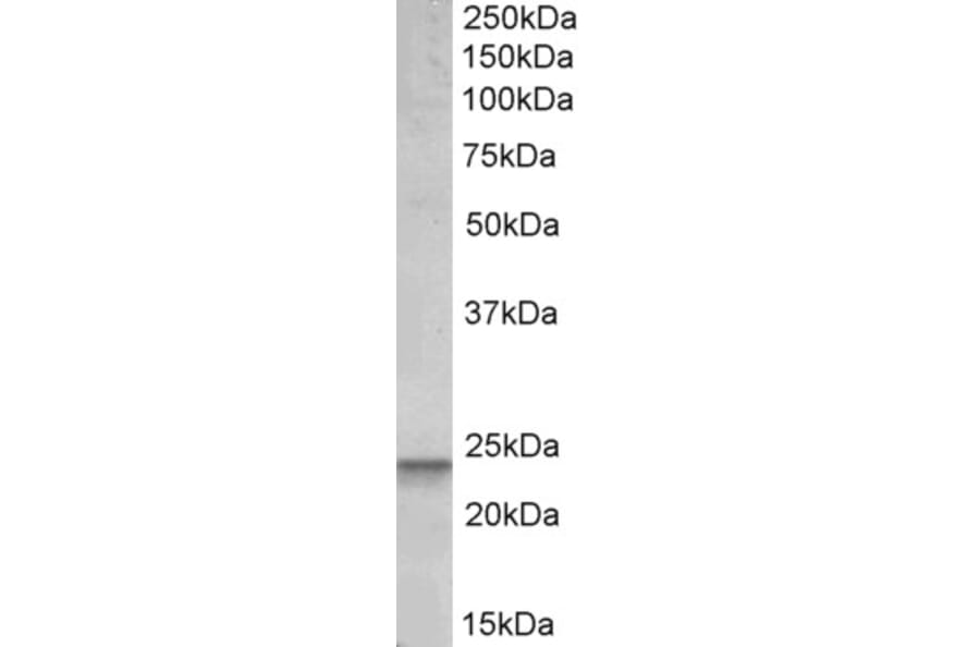 Western Blot - Anti-PUMA Antibody (A82709) - Antibodies.com