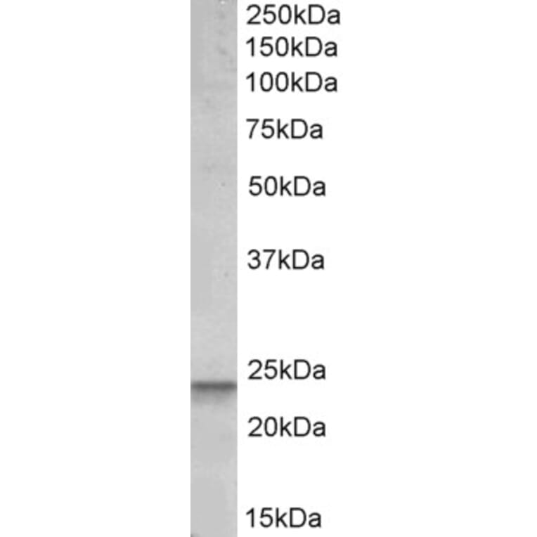 Western Blot - Anti-PUMA Antibody (A82709) - Antibodies.com