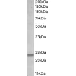 Western Blot - Anti-PUMA Antibody (A82709) - Antibodies.com