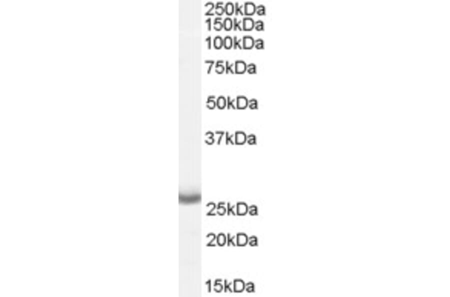 Western Blot - Anti-APH1A Antibody (A82710) - Antibodies.com