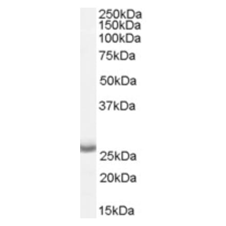 Western Blot - Anti-APH1A Antibody (A82710) - Antibodies.com