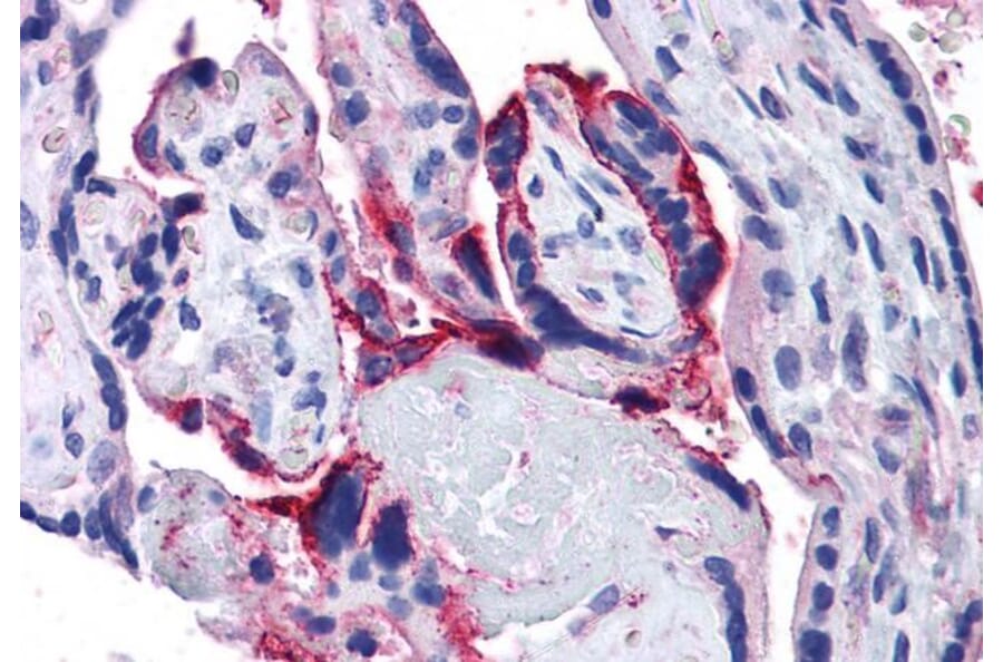 Immunohistochemistry - Anti-APH1A Antibody (A82710) - Antibodies.com
